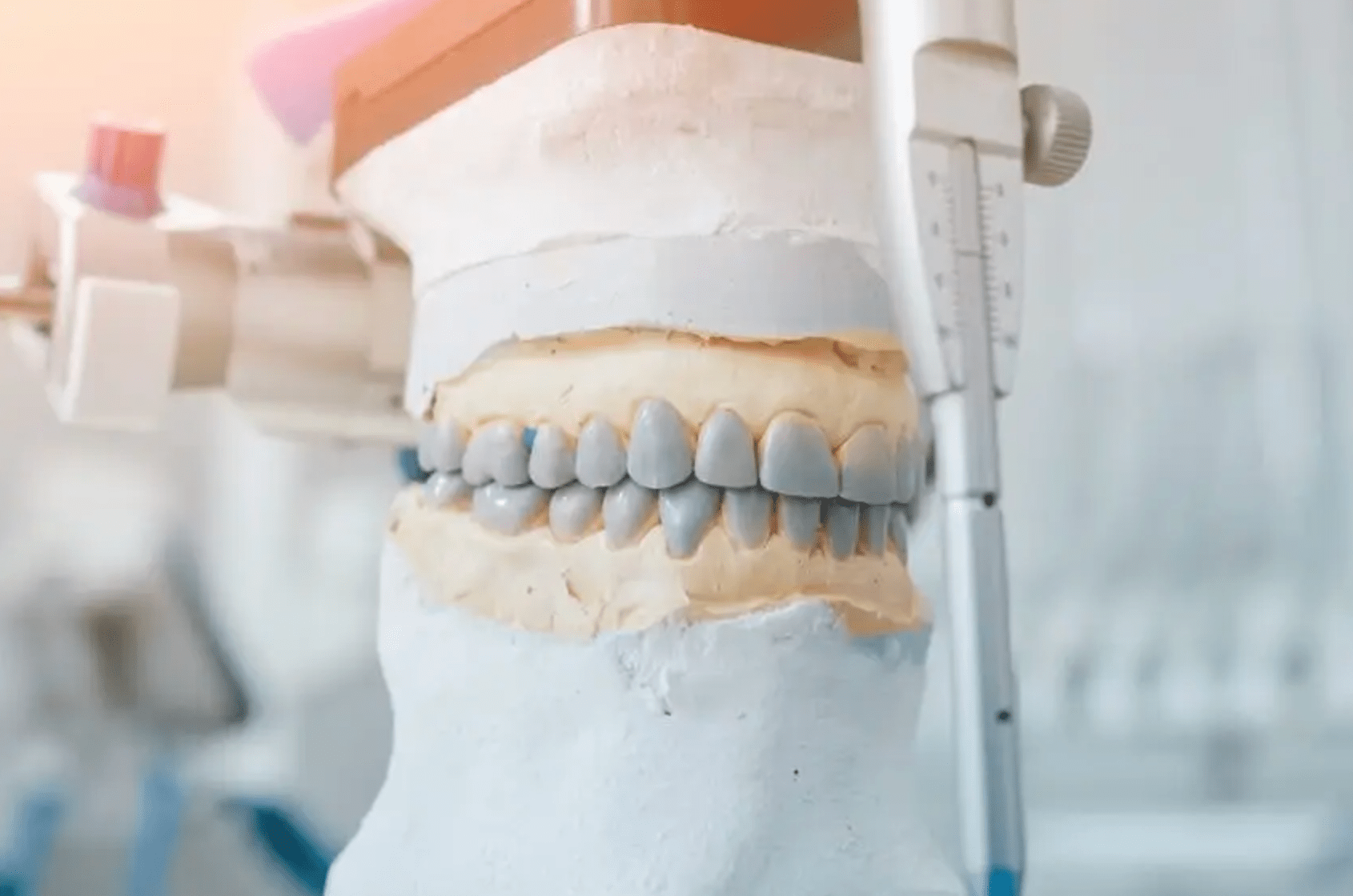 Professionelle Bisshebung Berlin - Zahnästhetik